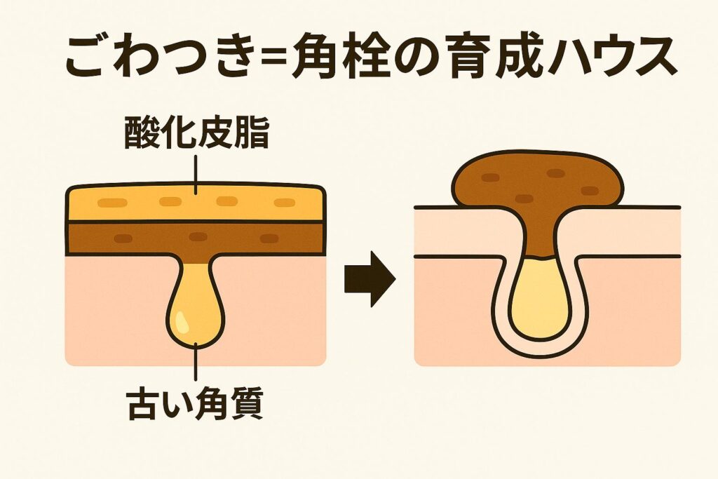 図解イラスト：左側に酸化皮脂（黄ばみ）と古い角質（茶色）が層となって膜を作り、鼻の毛穴出口を覆っている断面図。右側には、その膜が毛穴を塞ぎ角栓化している様子が描かれている。上部には『ごわつき＝角栓の育成ハウス』と書かれている。