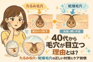 40代から毛穴が目立ちやすくなる理由を、たるみ毛穴と乾燥毛穴の違いから解説するイラスト。肌のハリ低下によるたるみ毛穴、皮脂や潤い不足による乾燥毛穴をそれぞれ毛穴断面図で示し、鏡で頬を気にする女性とともに、正しい対策とケア習慣の重要性をわかりやすく表現している。