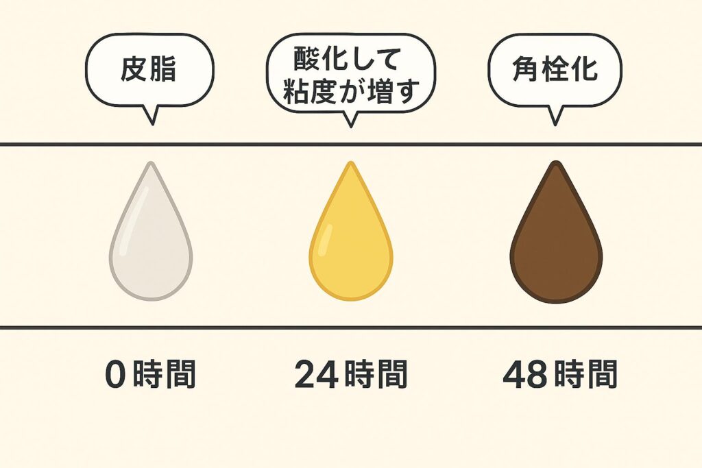 皮脂が48時間で角栓化する流れを示したタイムライン図。
0時間:透明な皮脂のしずく、24時間:黄色で粘度が増したしずく、48時間:茶色に固化したしずく。
吹き出しで「皮脂」「酸化して粘度が増す」「角栓化」と説明されている。