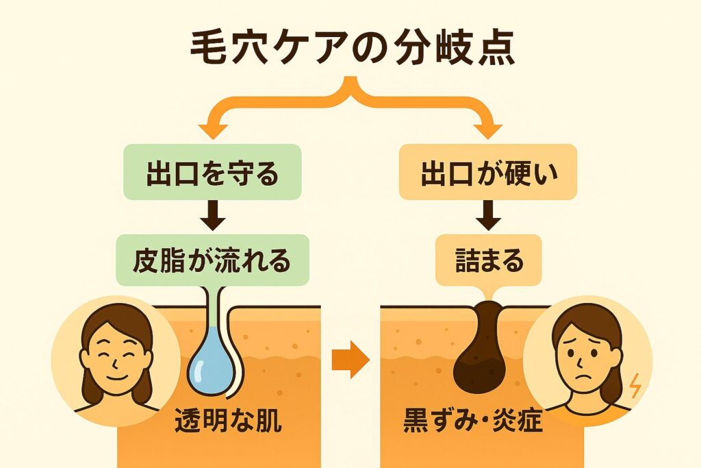 「毛穴ケアの分岐点」と題したイラスト。
左ルート:出口を守る → 皮脂が流れる → 透明な肌(笑顔の女性イラストつき)。
右ルート:出口が硬い → 詰まる → 黒ずみ・炎症(悩んだ表情の女性イラストつき)。
毛穴ケアの習慣が結果の分かれ道になることを示した図解。