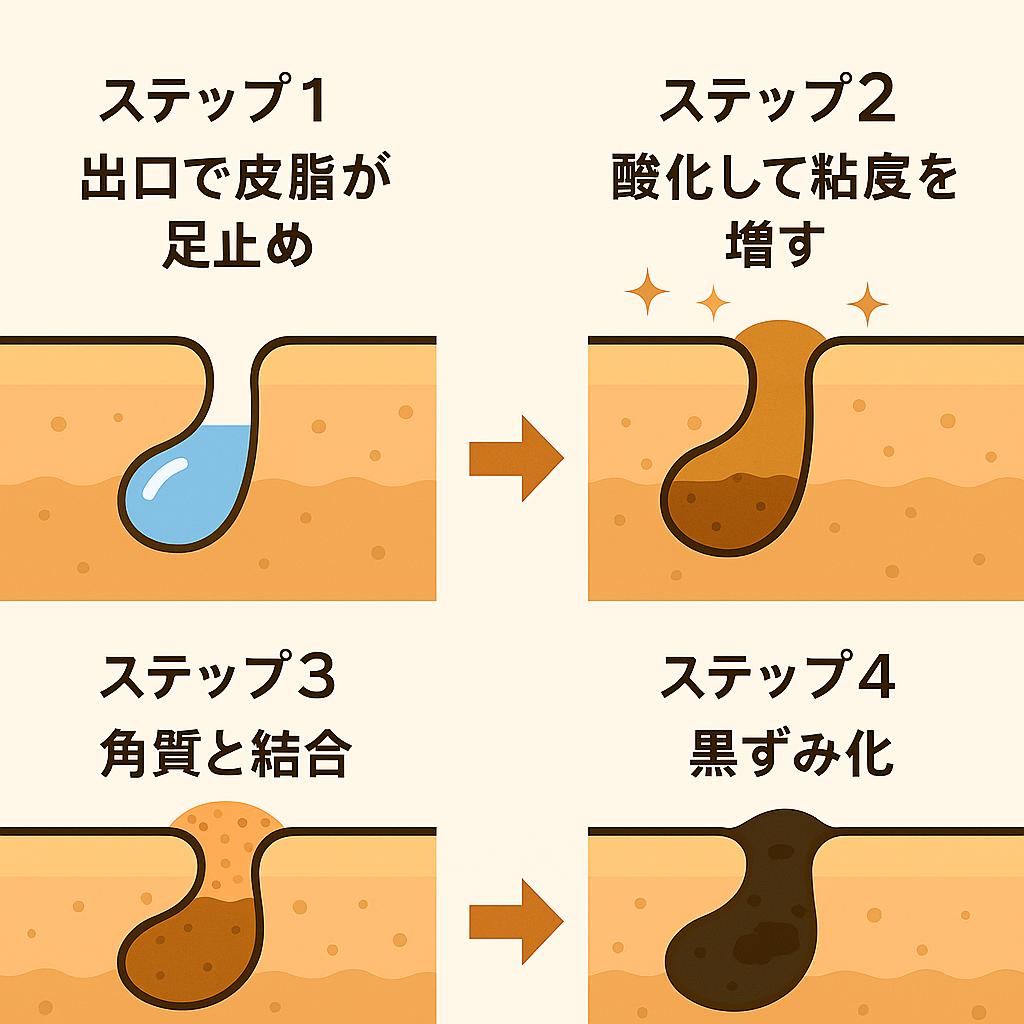 「角栓ができる4ステップ」を示す日本語インフォグラフィック。
出口で皮脂が足止め
酸化して粘度を増す
角質と結合
黒ずみ化
という流れを矢印でつないで図解し、角栓が形成されていく過程を視覚的に説明している。
