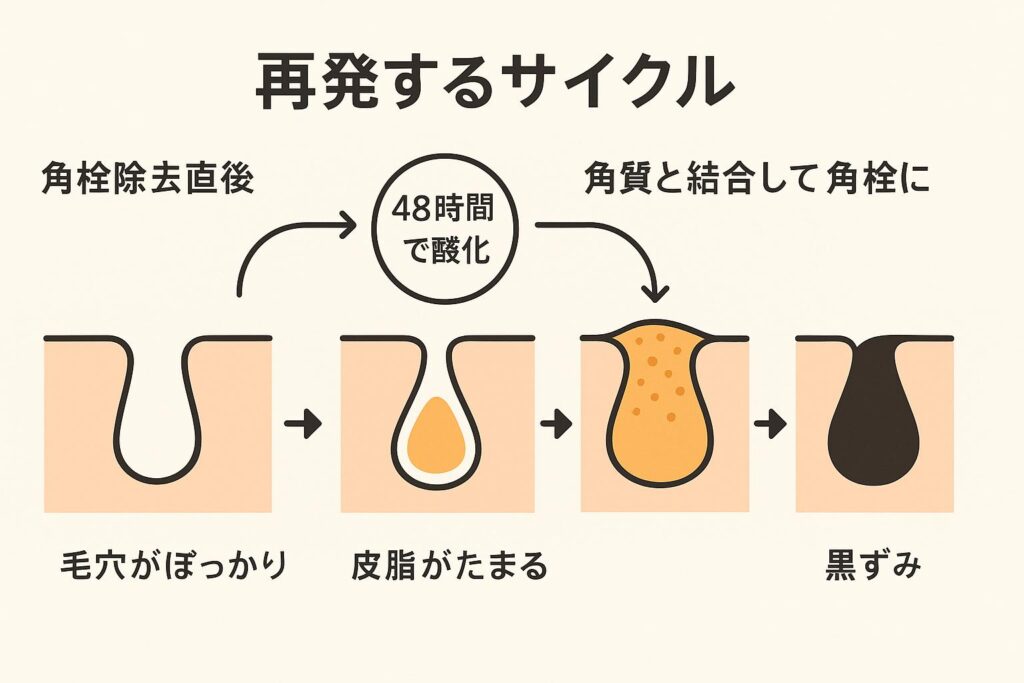 「毛穴の再発サイクルを示す図。角栓除去直後にぽっかり開いた毛穴 → 皮脂がたまり → 48時間で酸化 → 角質と結合して角栓に → 黒ずみができる、という流れを矢印で説明している。」