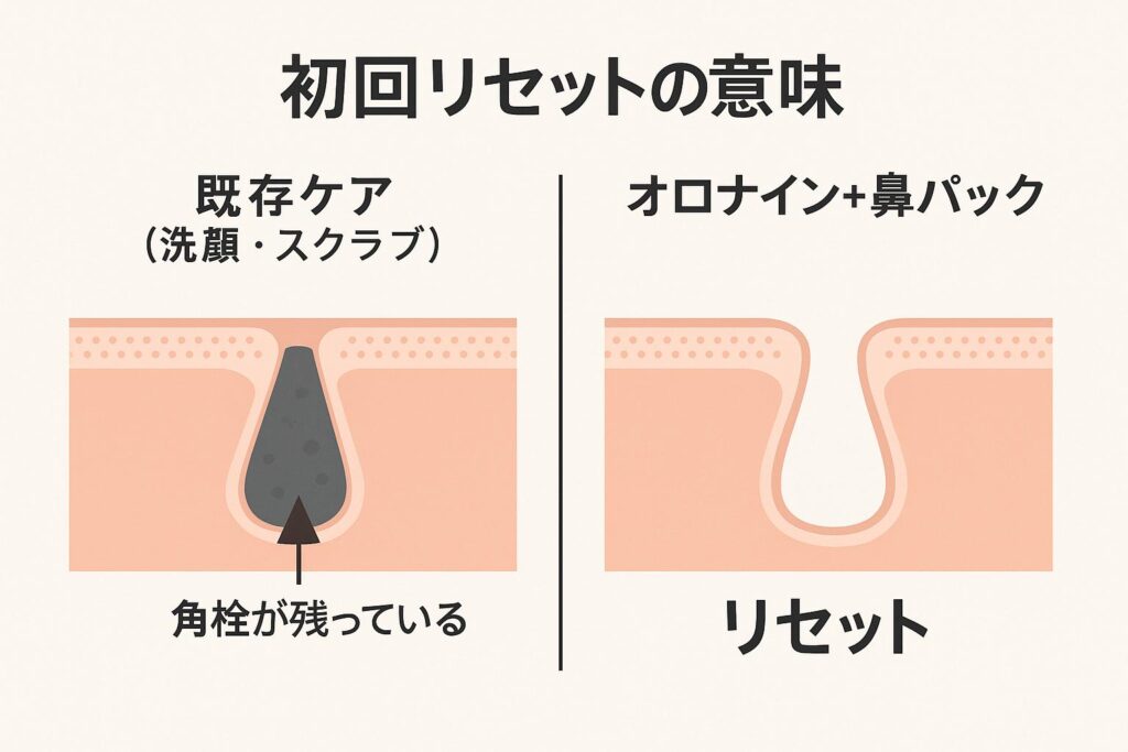 「初回リセットの意味」というタイトルの比較図。
左側は「既存ケア(洗顔・スクラブ)」と書かれ、毛穴の奥に黒い角栓が残っている断面イラスト。
右側は「オロナイン+鼻パック」と書かれ、角栓がなくなり毛穴がきれいにリセットされた断面イラストが描かれている。