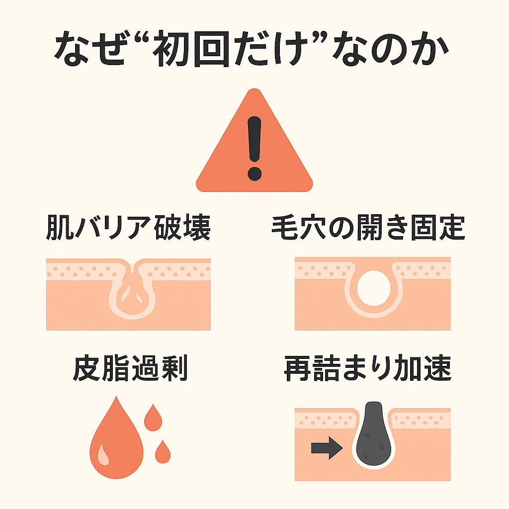 「なぜ“初回だけ”なのか」というタイトルのリスクまとめ図。中央に赤い警告マークがあり、その周囲に4つのリスクが配置されている。
左上:「肌バリア破壊」→角質層がダメージを受けた毛穴断面イラスト
右上:「毛穴の開き固定」→広がったまま閉じにくい毛穴断面イラスト
左下:「皮脂過剰」→赤いしずくアイコン
右下:「再詰まり加速」→角栓が再び詰まっていく毛穴断面イラスト
👉「繰り返すと危険」というメッセージを直感的に伝える構成。