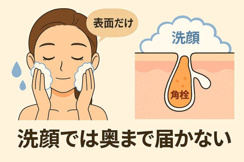 アニメ調の図解イラスト。左側では女性が泡洗顔で顔を洗っており、吹き出しに「表面だけ」と表示。右側は毛穴の断面図で、泡が表面に留まり、毛穴の奥には「角栓」が残っている様子が描かれている。下部には「洗顔では奥まで届かない」と大きく説明されている。
