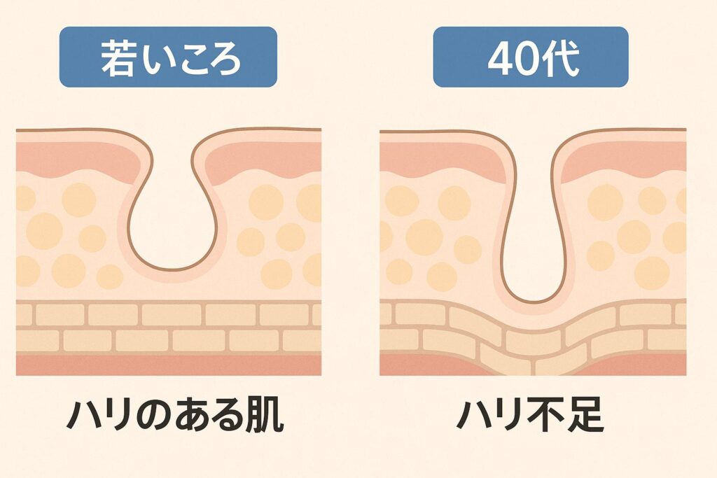「若いころの肌」と「40代の肌」の断面比較図。
左はハリがある丸い毛穴、右はハリ不足で縦に伸びた毛穴が描かれ、40代特有の構造変化を表現。 