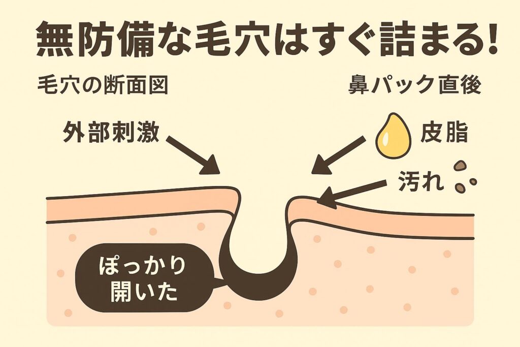 鼻パック直後の毛穴断面図。角栓が抜けて“ぽっかり開いた”状態の毛穴に、外部刺激・皮脂・汚れが入りやすくなっている様子を矢印で示したイラスト。上部には「無防備な毛穴はすぐ詰まる！」と書かれている。