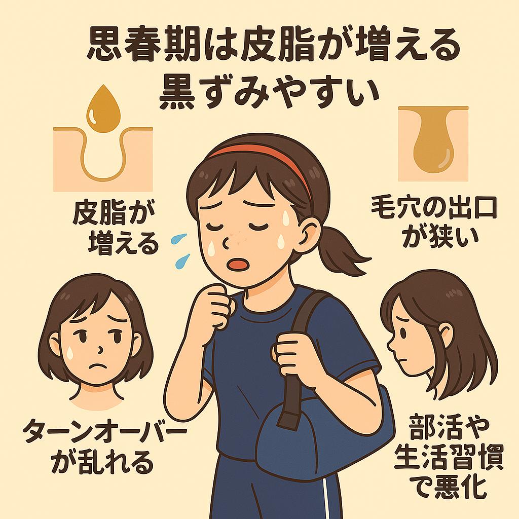 「思春期の肌の特徴を説明するインフォグラフィック。中央に部活帰りで汗をかいた中学生女子のイラスト。周囲に『皮脂が増える』『毛穴の出口が狭い』『ターンオーバーが乱れる』『部活や生活習慣で悪化』と書かれ、思春期に黒ずみが増える理由を示している。」