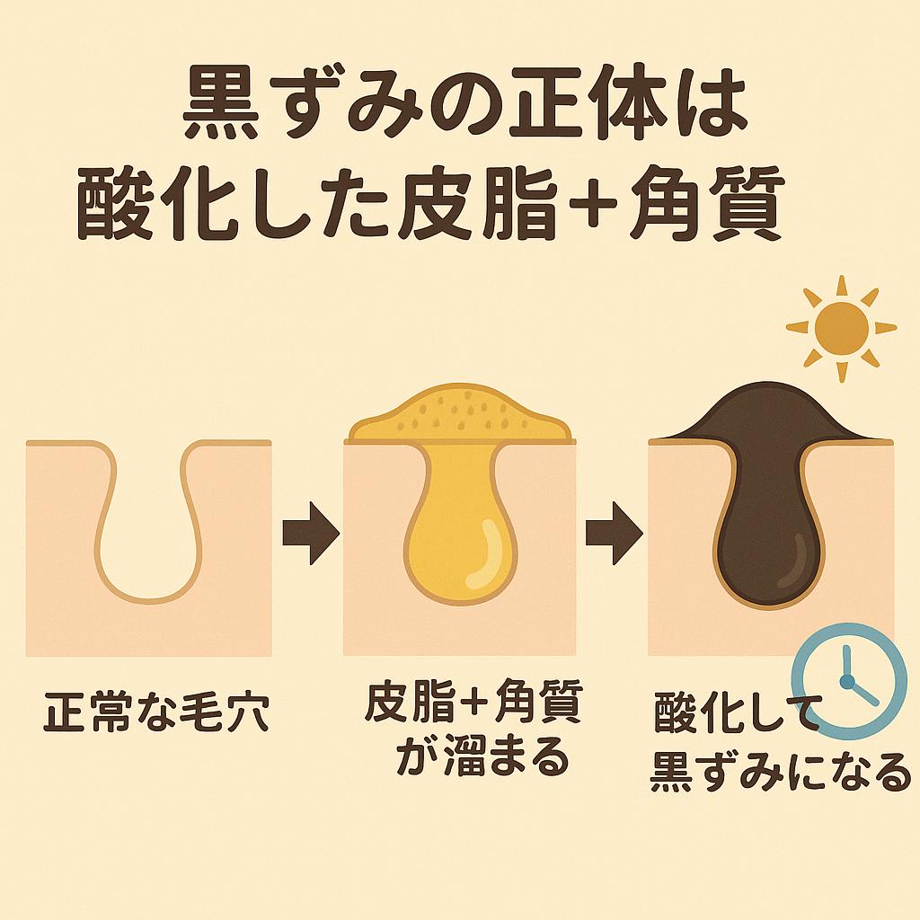 「黒ずみができる仕組みを説明する正方形の図解。左から順に、正常な毛穴 → 皮脂と角質が溜まった毛穴 → 時間と紫外線の影響で酸化し黒ずみになった毛穴を示している。上部には『黒ずみの正体は酸化した皮脂＋角質』と書かれている。」