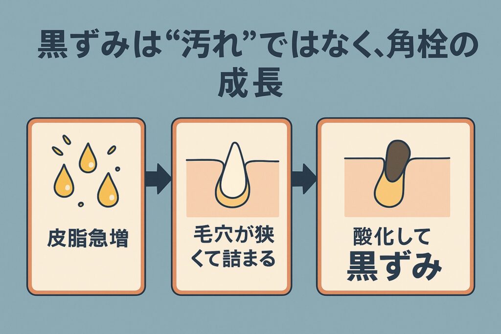 黒ずみ発生プロセスを示す流れ図。左から「皮脂急増」→「毛穴が狭くて詰まる」→「酸化して黒ずみ」と矢印で進む。上部には「黒ずみは“汚れ”ではなく、角栓の成長」と書かれている。