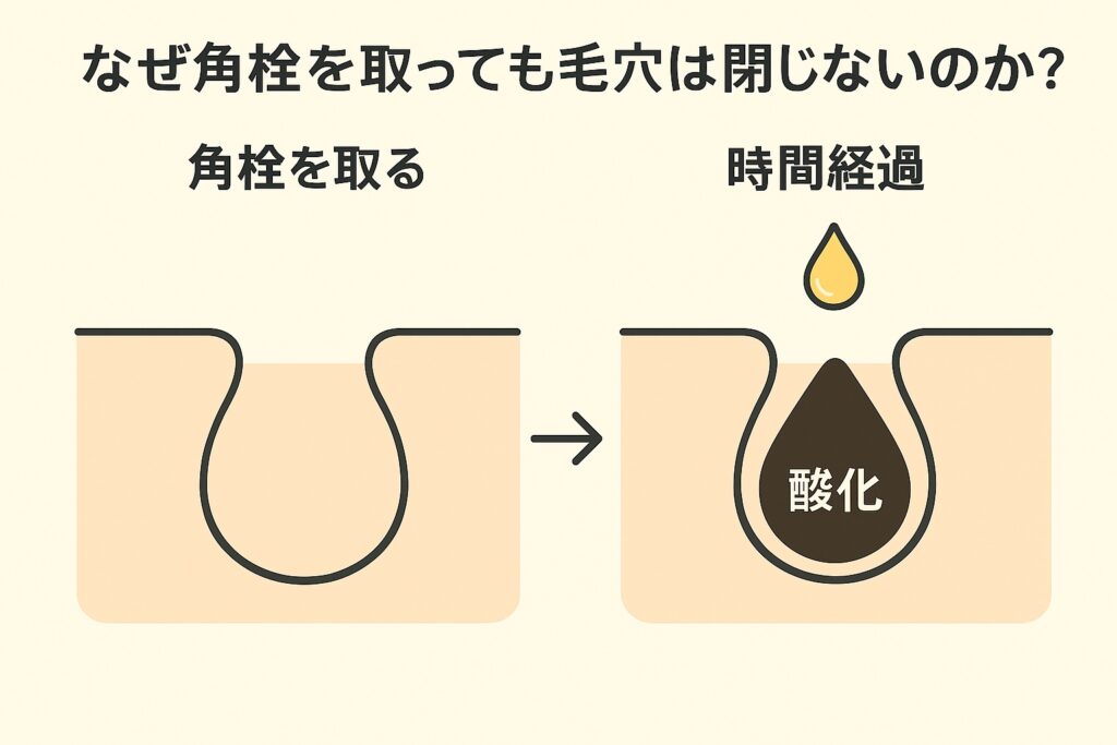 毛穴断面の比較図。「角栓を取る」と毛穴が空洞になるが、「時間経過」で皮脂が酸化し、再び角栓ができる仕組みを示したイラスト。毛穴が閉じない理由を視覚的に説明している。
