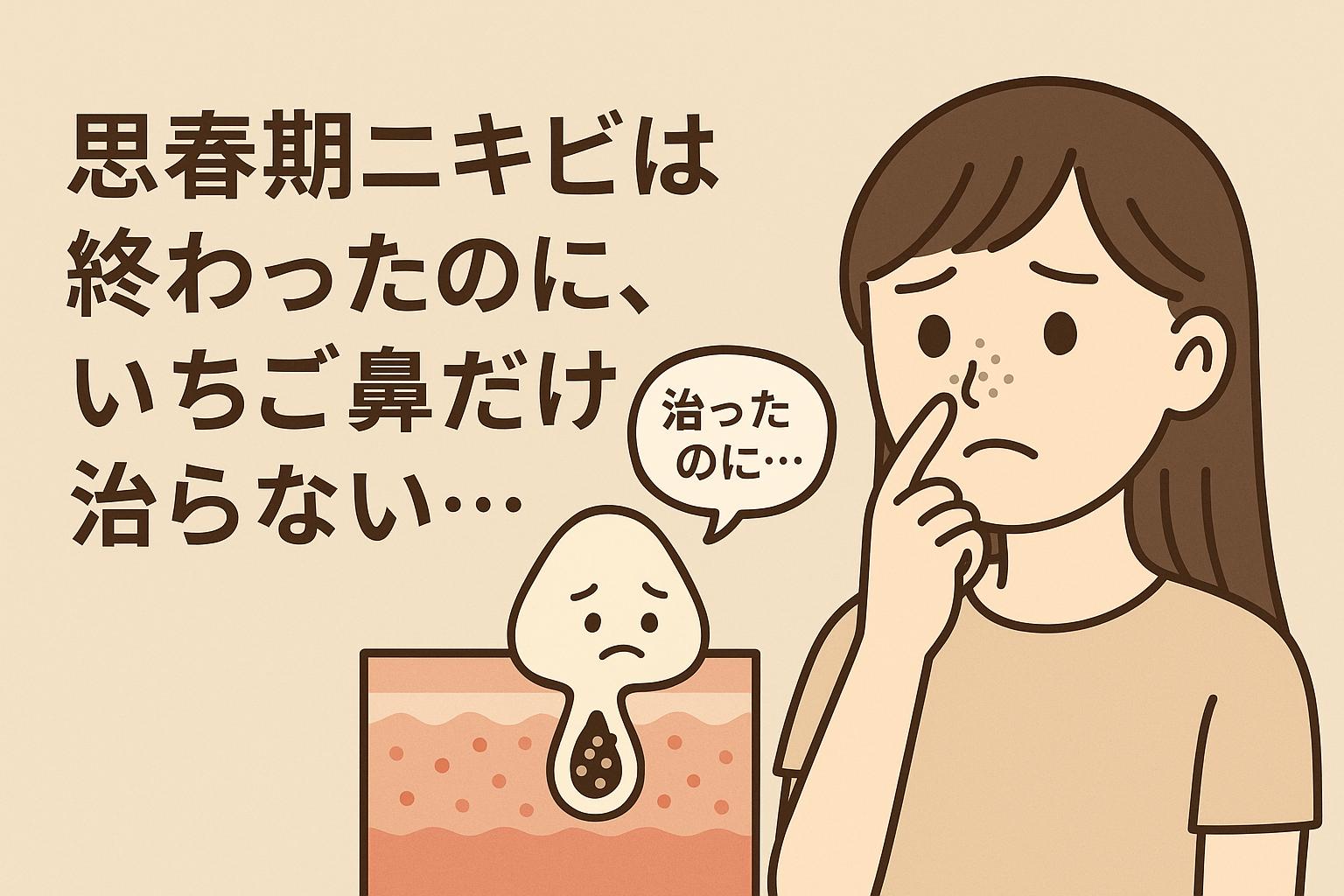 　「思春期ニキビは終わったのに、いちご鼻だけ治らない…」というタイトル。左に「ニキビは治ったのに」とつぶやく毛穴キャラ、中央に黒ずみ・角栓の構造図、右に鼻の黒ずみを気にする女子大生。