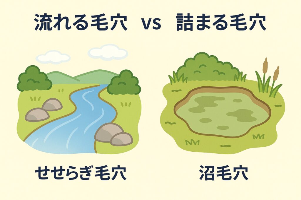 「毛穴の状態を比喩で表した図解イラスト。左は透明な水が流れる小川で『せせらぎ毛穴』、右は濁った水がたまる沼で『沼毛穴』と表示されている。上部に『流れる毛穴 vs 詰まる毛穴』のテキストがあり、健康な毛穴と詰まった毛穴の違いを視覚的に表現している。」