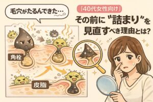 40代女性の毛穴が目立つ原因を解説する図解イラスト。毛穴のたるみの前段階として、皮脂と角質が詰まり角栓を形成し、それが毛穴を押し広げる構造を、鏡を持つ女性と拡大図で示している。