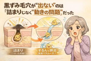 黒ずみ毛穴ができる原因は「詰まり」ではなく皮脂や角質の“動き”の問題であることを示す図解イラスト。詰まって停滞した状態と、流れてスムーズに排出される状態を毛穴断面で比較し、驚く女性の表情とともに説明している。