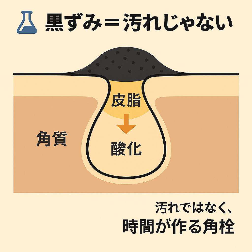 毛穴の断面図を示す日本語インフォグラフィック。
皮脂が毛穴内にたまり、酸化して黒色の角栓となる様子を層構造で表現。
タイトルに「黒ずみ＝汚れじゃない」、右下には「汚れではなく、時間が作る角栓」と記載され、黒ずみの正体が酸化した角栓であることを強調している。 