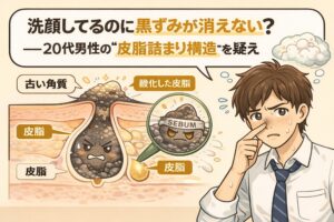 洗顔しているのに鼻の黒ずみが消えない20代男性の悩みを解説するイラスト。古い角質と酸化した皮脂が重なって毛穴に詰まる「皮脂詰まり構造」を毛穴断面図で表現し、拡大図では黒ずんだ皮脂（SEBUM）が強調されている。右側には鼻を気にして触れる若い男性が描かれ、黒ずみの原因が洗い残しではない可能性を示している。