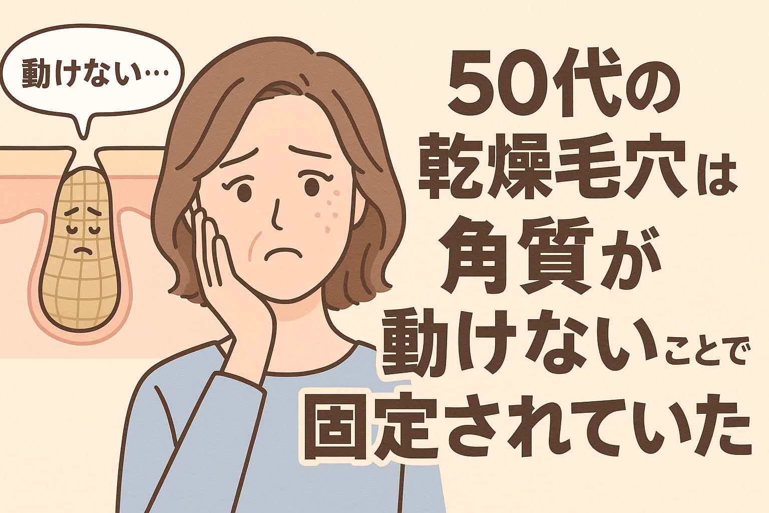 50代女性の乾燥毛穴をテーマに、動けない角質が毛穴内に固定された様子を描いたイラスト。困った表情の女性と「動けない…」と語る角質キャラが登場し、毛穴の固定化構造を視覚的に表現している。