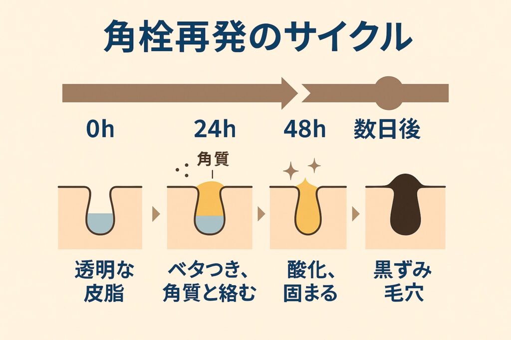 「角栓再発のサイクル」を示す時間軸イラスト。
0h:透明な皮脂が毛穴に存在
24h:皮脂がベタつき、角質と絡む
48h:酸化して固まり始める
数日後:黒ずみ毛穴に進行
皮脂の変化が「透明 → 黄色 → 固化 → 黒ずみ」と段階的に描かれており、“48時間ルール”を強調している。