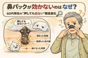 鼻パックが効かなくなる理由を、60代男性に多い毛穴構造の変化から解説したイラスト。固まった皮脂、肥厚した毛穴壁、硬くなった角質によって、押しても角栓が出てこない状態を、毛穴断面図と悩む男性の表情で分かりやすく示している。