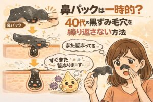 鼻パックは一時的な効果にとどまることを解説する図解イラスト。鼻パックで角栓が取れた直後の状態と、すぐに毛穴の奥で再び詰まりが起こる様子が段階的に描かれている。右側では40代女性が鼻パックを外して驚く表情をしており、「また詰まってる」「すぐまた詰まります」という吹き出しで再発の仕組みが示されている。40代の黒ずみ毛穴を繰り返さないためには、鼻パック以外の継続ケアが必要であることを伝える教育用ビジュアル。