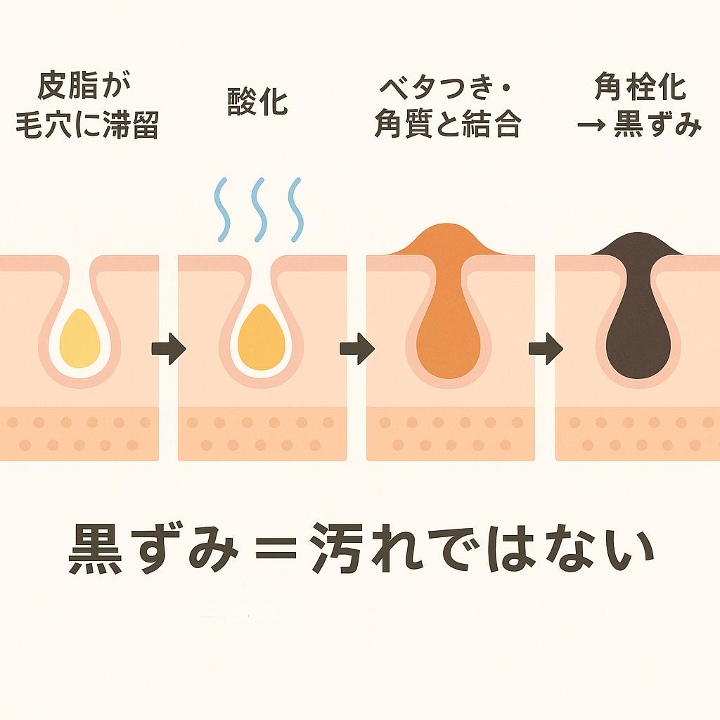「酸化皮脂→角栓化の流れ」を示す断面イラスト。
左から順に「皮脂が毛穴に滞留」「酸化」「ベタつき・角質と結合」「角栓化→黒ずみ」の4段階を矢印で示し、下部に「黒ずみ=汚れではない」と強調している。