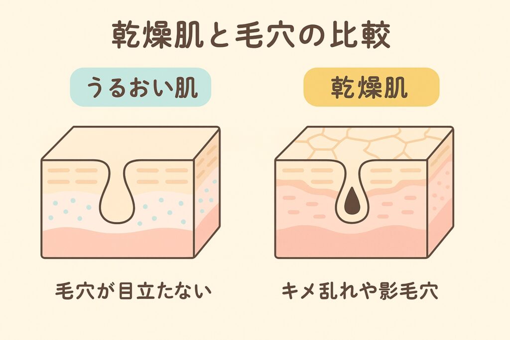 乾燥肌と毛穴の比較を示すイラスト。左は「うるおい肌」で毛穴が目立たず、キメが整っている。右は「乾燥肌」でキメが乱れ、毛穴に影ができて目立つ状態を断面図で表現。
