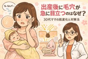 出産後に毛穴が急に目立つ理由を、30代ママのイラストと毛穴断面図で解説した図。ホルモン変化（エストロゲン低下）、乾燥、皮脂バランスの乱れによって毛穴が開きやすくなる肌変化と、その背景を示している。