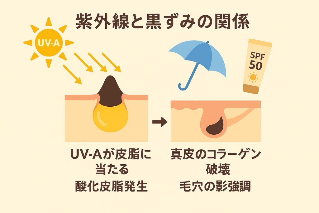 紫外線と黒ずみの関係を示す横長フラットイラスト。左側はUV-Aが皮脂に当たり酸化皮脂が発生する様子、右側は真皮のコラーゲン破壊により毛穴の影が強調される様子を描く。日傘とSPF50日焼け止めのアイコンで紫外線対策を明示。背景は淡いベージュ。
