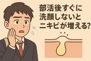 部活後のスキンケアをテーマにしたイラスト。汗をかいた男子高校生が頬のニキビを気にしている。右側には毛穴の中に皮脂が詰まって膨らんだ断面図が描かれ、「部活後すぐに洗顔しないとニキビが増える？」というテキストが配置されている。