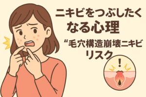 ニキビをつぶしたくなる心理とリスクを描いたイラスト。女性が鏡を見ながら赤いニキビを指で押そうとしている。左側に黄色い稲妻マークがあり、痛みや刺激を示している。右下の毛穴断面図では、炎症を起こした毛穴が破裂している様子が描かれ、「毛穴構造崩壊ニキビリスク」と書かれている。テキストには「ニキビをつぶしたくなる心理 “毛穴構造崩壊ニキビリスク”」と記載されている。
