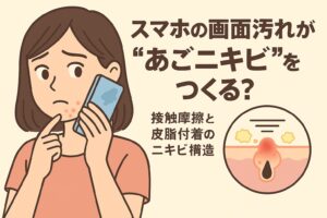 スマートフォンの画面汚れによる“あごニキビ”の原因を描いたイラスト。女性が頬やあごのニキビを気にしながらスマホを顔に当てている。右下の毛穴断面図には皮脂や汚れの付着が示され、摩擦と菌の影響で炎症が起きている様子が描かれている。テキストには「スマホの画面汚れが“あごニキビ”をつくる？ 接触摩擦と皮脂付着のニキビ構造」と記載されている。