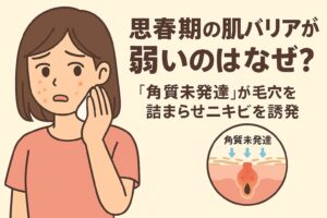思春期の肌バリアの弱さをテーマにしたイラスト。頬にニキビがある女子学生が不安そうな表情で顔を触っている。右下の毛穴断面図では「角質未発達」と書かれ、未熟な角質層によって毛穴が詰まり炎症を起こしている様子が描かれている。テキストには「思春期の肌バリアが弱いのはなぜ？『角質未発達』が毛穴を詰まらせニキビを誘発」と記載されている。