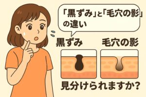 「『黒ずみ』と『毛穴の影』の違い──見分けられますか？」を説明するイラスト。 左側には黒ずみと影の違いに戸惑う女性。 右側には2つの皮膚断面図が並び、左は酸化した皮脂による黒ずみ、右は毛穴のくぼみに光が当たってできる“影”を示している。 黒ずみと影は見た目が似ていても原因が異なることを視覚的に比較した図。