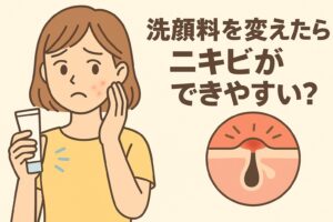 洗顔料を変えた後にニキビができる原因をテーマにしたイラスト。黄色い服の女性が不安そうな表情で頬のニキビを気にしており、手には洗顔料のチューブを持っている。右下の毛穴断面図には炎症を起こした毛穴が描かれ、洗浄成分の変化によるバリア機能の乱れを示している。テキストには「洗顔料を変えたらニキビができやすい？」と書かれている。