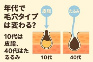 「年代で毛穴タイプは変わる？──10代は皮脂、40代はたるみ」を説明するイラスト。左側には10代の皮脂詰まり毛穴の断面図、右側には40代のたるみ毛穴の断面図が並んで描かれている。10代は皮脂分泌が多く詰まりやすい一方、40代は肌の支えが弱まり、毛穴が縦に伸びて見える“たるみ毛穴”になりやすいことを視覚的に比較した図。