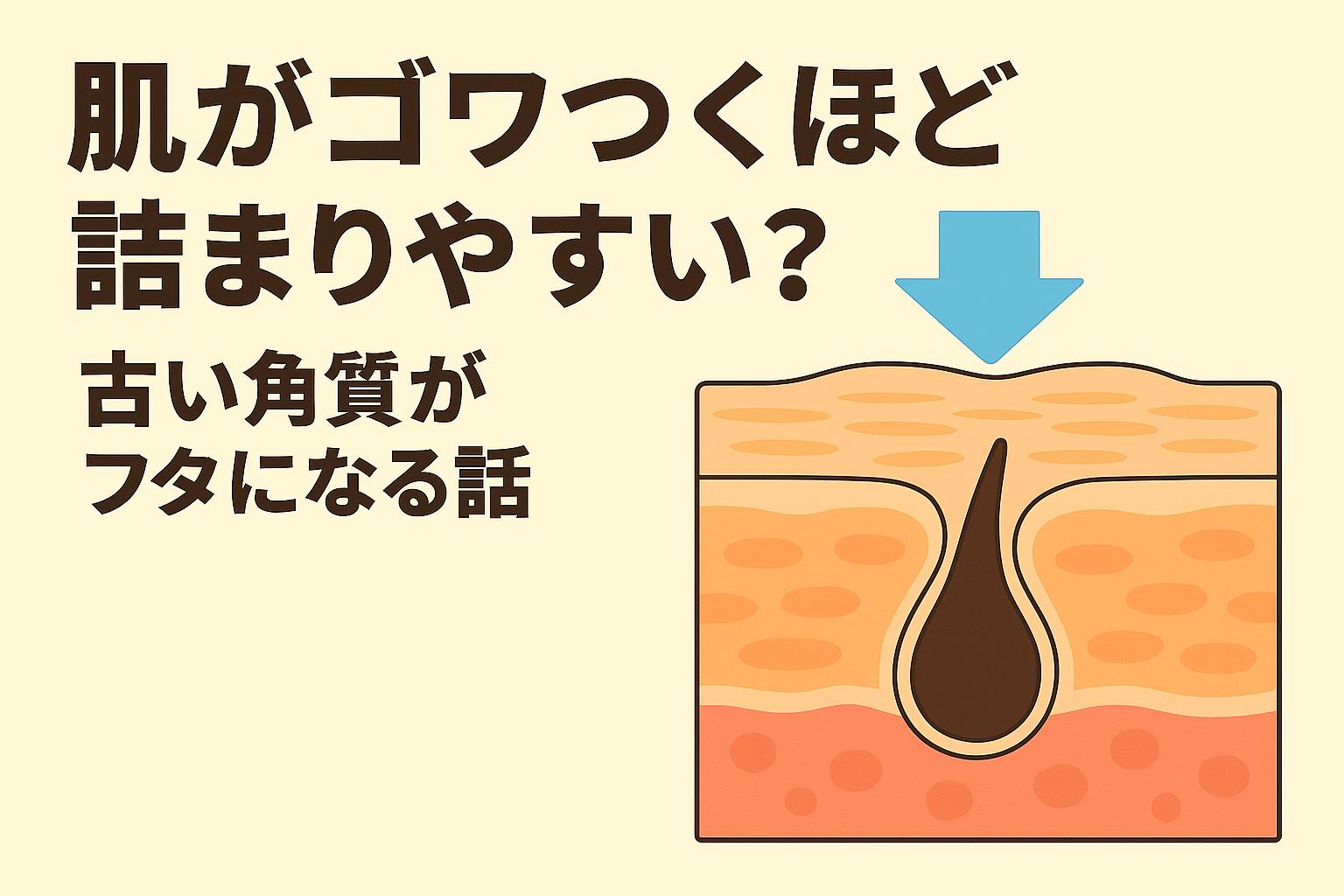 「肌がゴワつくほど詰まりやすい？──古い角質がフタになる話」を説明するイラスト。右側の皮膚断面図では、角層が分厚くゴワついた状態になり、毛穴の出口が塞がれて皮脂が出にくくなっている様子が描かれている。古い角質が“フタ”となり、毛穴詰まりを引き起こす仕組みを視覚的に示した図。