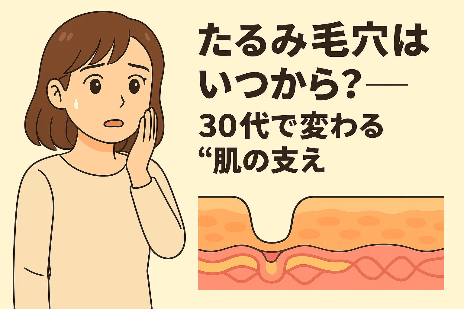 「たるみ毛穴はいつから？──30代で変わる“肌の支え”」をテーマにしたイラスト。左側では鏡を見ながら頬のたるみ毛穴に不安を感じる女性。右側の皮膚断面図には、真皮層のコラーゲンやエラスチンがゆるみ、毛穴の周囲が支えを失って楕円形に広がる様子が描かれている。30代以降に起こる肌のハリ低下が毛穴のたるみに影響する仕組みを示す解説図。