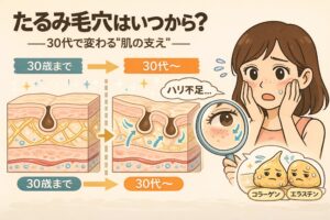 たるみ毛穴はいつから始まるのかを解説する図解イラスト。30歳までの肌と30代以降の肌を比較し、コラーゲンやエラスチンによる「肌の支え」が弱まることで毛穴が縦に伸び、たるみ毛穴が目立ち始める構造を示している。鏡で肌を確認して不安そうな女性と、成分キャラクターが描かれている。