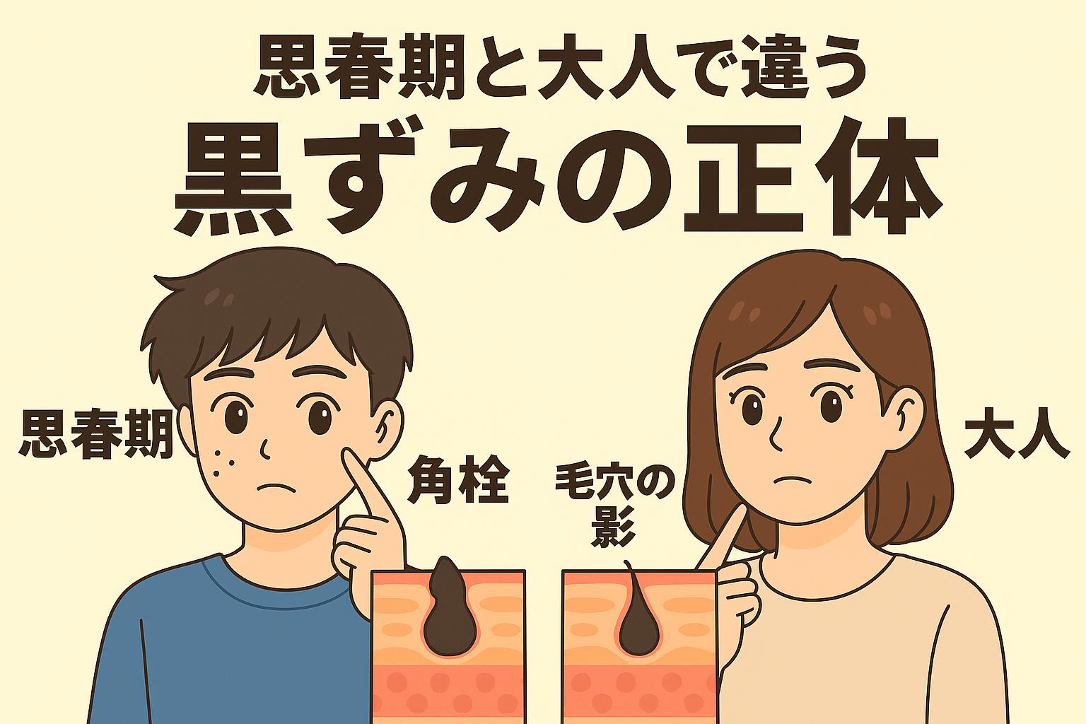 「思春期と大人で違う黒ずみの正体」を説明するイラスト。 左側には思春期の男の子が鼻の黒ずみを気にしており、その下には“角栓”の皮膚断面図。 右側には大人の女性が黒ずみを気にしていて、その下には“毛穴の影”を示す皮膚断面図。 思春期は皮脂が多く角栓が黒ずみやすいのに対し、大人は毛穴の構造や影によって黒く見えることがあるという違いを視覚的に示した図。