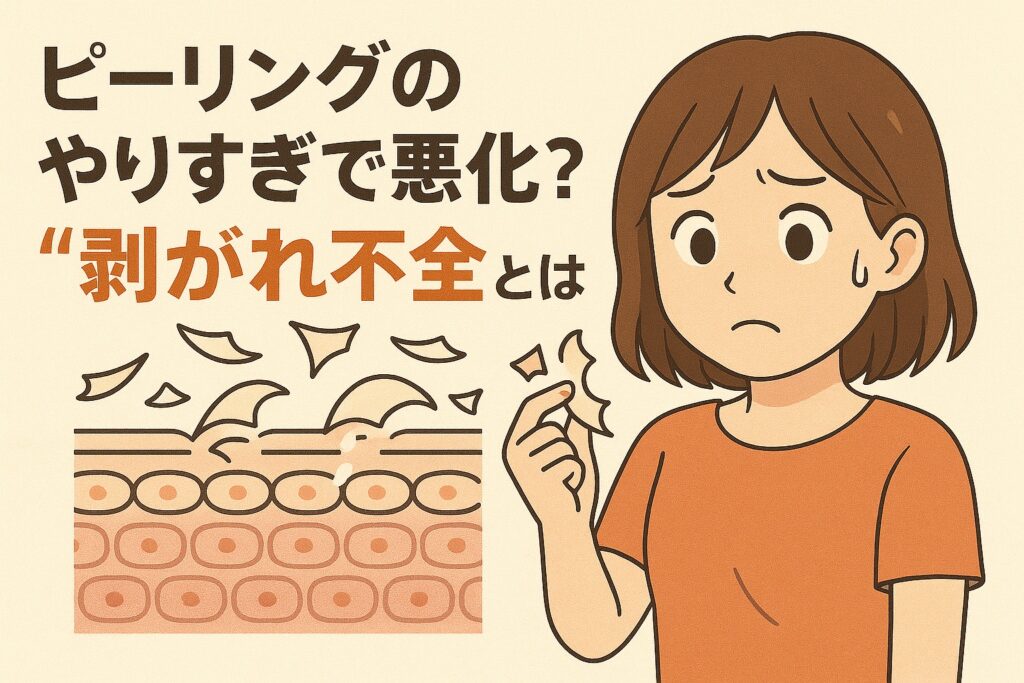 「ピーリングのやりすぎで悪化？“剝がれ不全とは”」というタイトルの横で、不安そうな表情の女性が皮むけした角質片を指でつまんでいるイラスト。下部には肌の角層構造と不完全に剥がれた角質が描かれ、過度なピーリングで起きる“剝がれ不全”を視覚的に説明するデザイン。