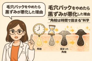 毛穴パックをやめた後に黒ずみが悪化した理由を解説するイラスト。角栓が時間の経過とともに固まり、除去されずに黒ずみとして目立つようになる過程を、時計や砂時計、毛穴断面図で示している。