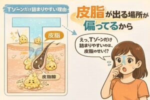 Tゾーンだけ毛穴が詰まりやすい理由を解説した図解イラスト。皮脂腺が集中して皮脂分泌が多いTゾーンの構造を断面図で示し、皮脂が偏って出ることで角栓ができやすくなる仕組みを分かりやすく表現している。