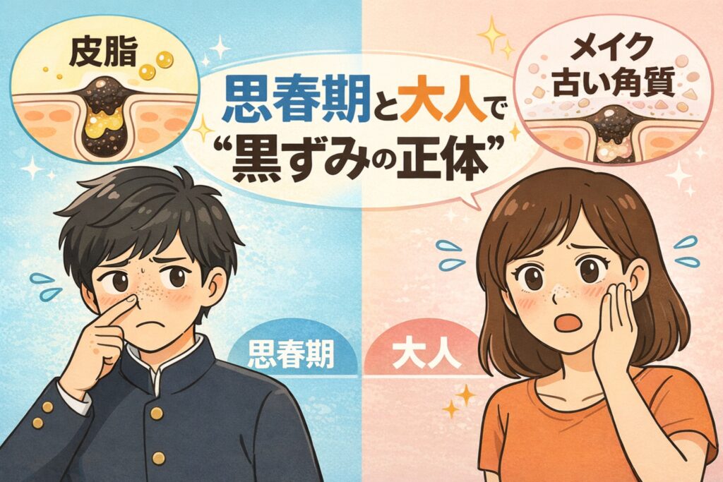 思春期と大人で黒ずみの正体が異なることを解説した比較図解イラスト。左側は思春期の皮脂分泌過多による黒ずみ、右側は大人のメイク残りや古い角質が関与した黒ずみを、毛穴断面図と人物イラストで対比している。年代による黒ずみ原因の違いを視覚的に分かりやすく示した教育的ビジュアル。