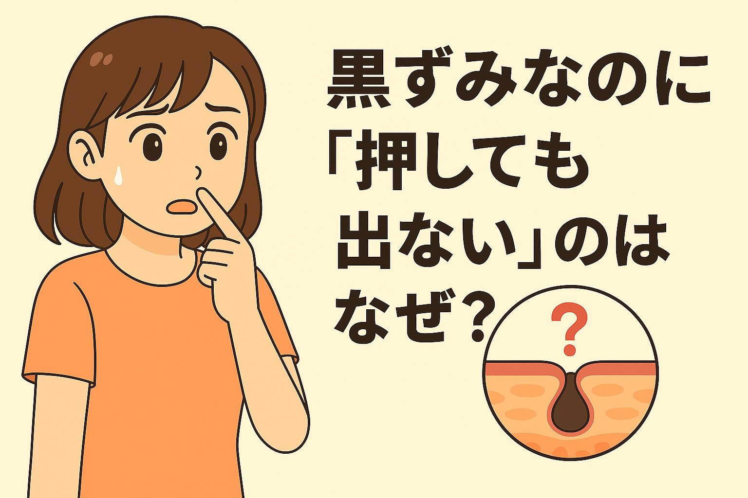 「黒ずみなのに『押しても出ない』のはなぜ?」を説明するイラスト。 左側には黒ずみが取れずに困惑する女性。 右側の円形の皮膚断面図では、黒ずみが“酸化した皮脂の表面変化”であり、押しても出ないタイプの黒ずみ(いわゆる開き毛穴の影や酸化膜)であることを示唆する疑問符が描かれている。 黒ずみの原因が“詰まり”ではないケースがあることを表した構図。