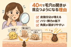 40代で毛穴の開きが目立つようになる理由を解説するイラスト。鏡を見て毛穴を気にする女性とともに、「皮脂分泌が増える」「ハリ・弾力の低下」「角質が溜まりやすい」といった要因がチェックリストで示されている。下部には皮脂、弾力低下、ターンオーバーの乱れを擬人化したキャラクターと毛穴断面図が描かれ、年齢とともに複数の要因が重なって毛穴が開きやすくなる構造を視覚的に伝えている。