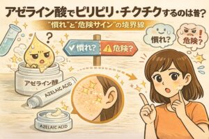 アゼライン酸を使ったときにピリピリ・チクチクする感覚が「慣れ」なのか「危険サイン」なのかを解説する図解イラスト。アゼライン酸クリームと擬人化キャラクター、分かれ道の標識で判断の境界線を表現し、赤みや刺激を感じて戸惑う女性が見極めポイントを確認している。敏感肌向けに、正常な反応と注意すべき反応の違いを分かりやすく示した教育的ビジュアル。