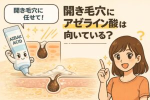 開き毛穴にアゼライン酸が向いているかどうかを解説するイラスト。アゼライン酸のチューブが毛穴断面に働きかける様子と、「開き毛穴にアゼライン酸は向いている？」という問いが描かれている。右側では女性が指を立ててポイントを説明し、アゼライン酸は皮脂や炎症を整える作用が期待できる一方、毛穴の構造そのものを変える成分ではないことを示し、適した使いどころを視覚的に伝えている。