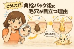 角栓パック後に毛穴が目立つ理由を解説する図解イラスト。角栓パック後の毛穴断面で皮脂が分泌され再び詰まる流れが示され、鏡で毛穴を確認して驚く女性と、不満そうな角栓キャラクターが描かれている。