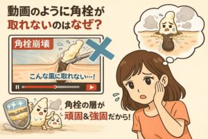 動画のように角栓が簡単に取れない理由を解説する図解イラスト。角栓崩壊動画の再生画面にはバツ印が付けられ、実際の角栓は層構造で頑固かつ強固であることが示され、不安そうに頬に手を当てる女性が描かれている。